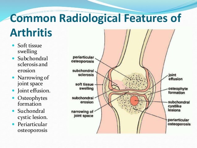 Radiography